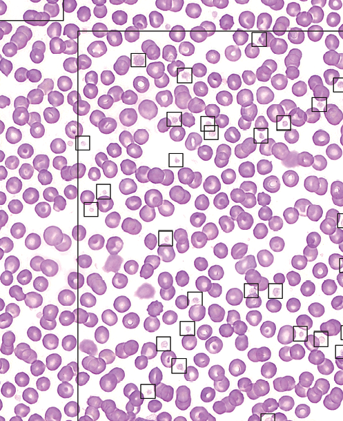 5_Platelets_Image_from_ScopioVet_automated_platelet_count_estimate_tool-Courtesy_of_Scopio_Labs.png